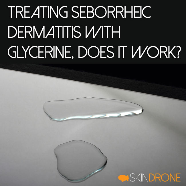 Treating Seborrheic Dermatitis with Glycerine Cover Photo