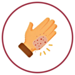 Emblem for Skin Support Module - Reducing Exposure to Known Irritants for Skin Health