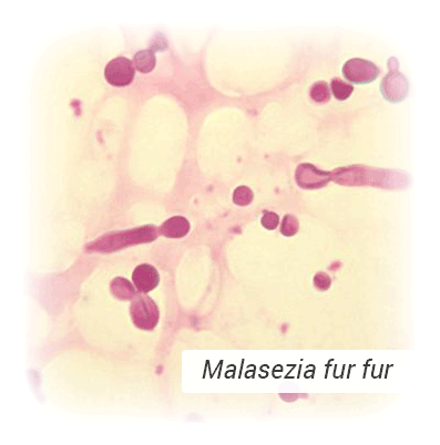 Malassezia Fur Fur on Skin Surace