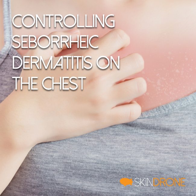 Controlling Seborrheic Dermatitis on the Chest Cover Photo