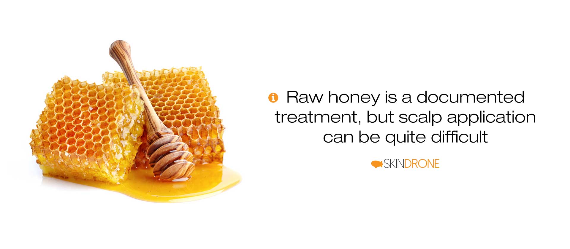Raw honey has documented effectivness for seborrheic dermatitis, but scalp treatment remains difficult