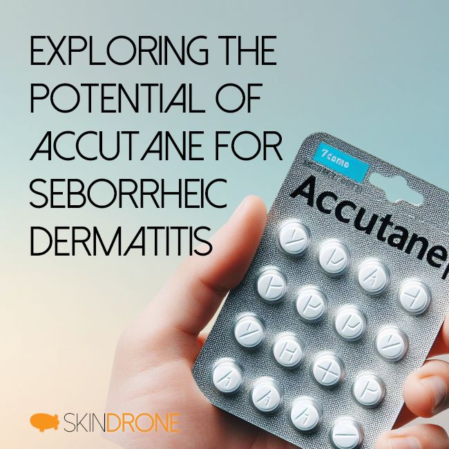 Hand holding blister pack of Accutane tablets - article title "Exploring the Potential of Accutane for Seborrheic Dermatitis " in top left corner