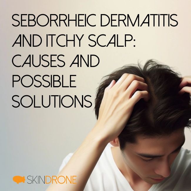 Man scratching scalp affected by seborrheic dermatitis and experiencing bothersome itchiness. Article title "Seborrheic Dermatitis and Itchy Scalp: Causes and Possible Solutions' appears on left side.
