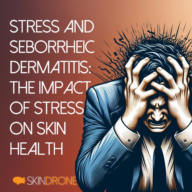 An article banner showing a heavily stressed out person in the bottom right corner holding his head. The article title "Stress and Seborrheic Dermatitis: The Impact of Stress on Skin Health" appears in the top left of the banner.