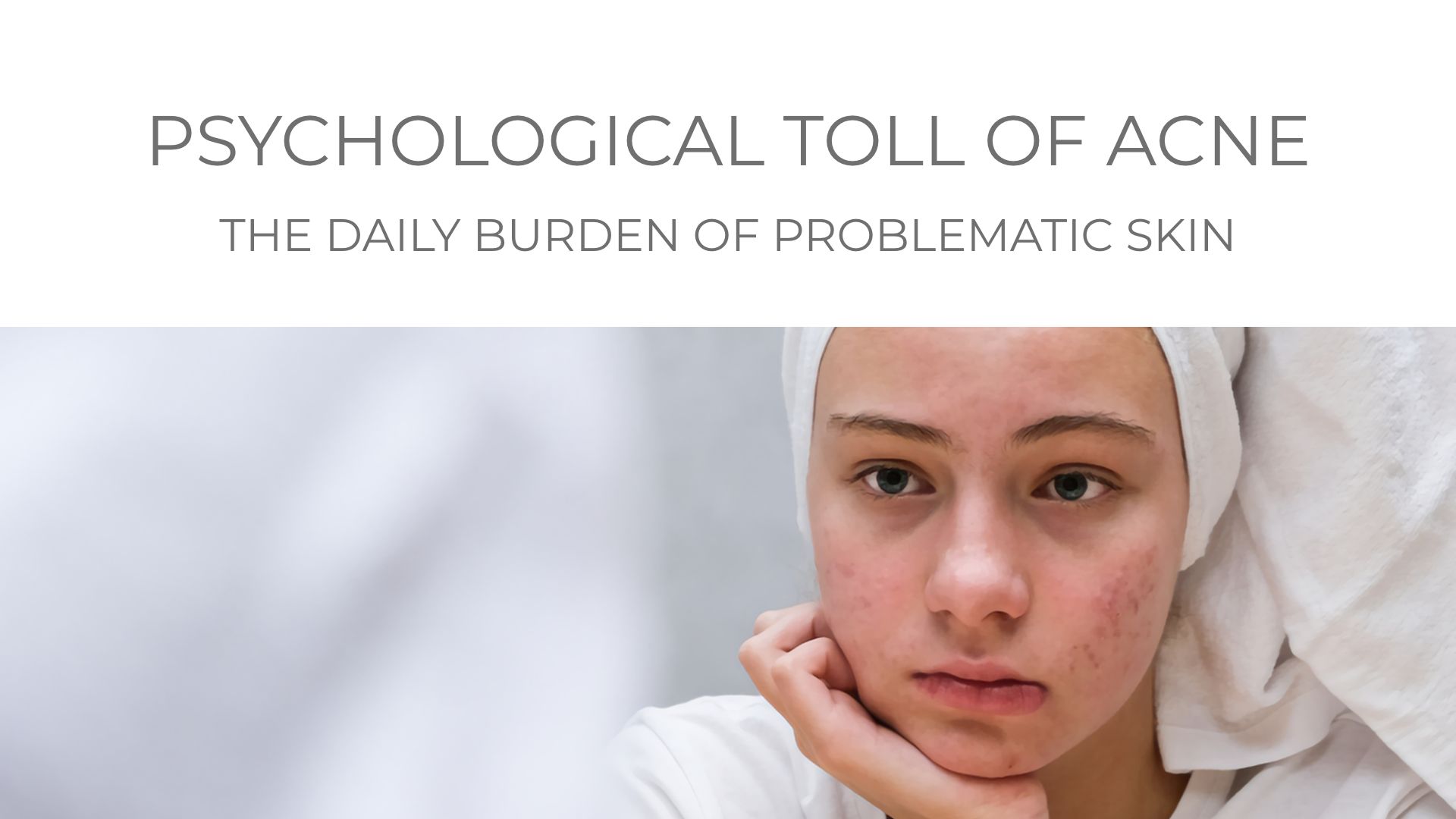Facial redness and inflammatory acne lesions depicting psychological effects