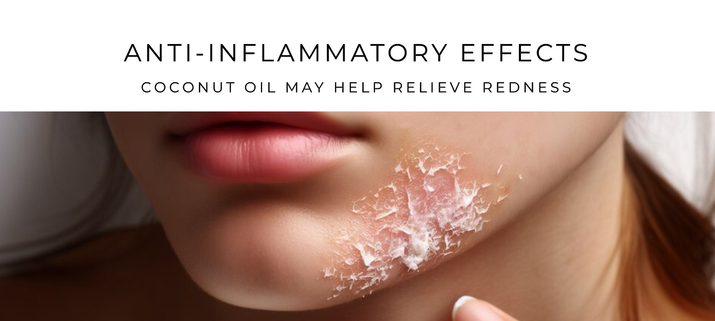 A banner that shows inflammation of the cheek with a liber amount of coconut applied over top